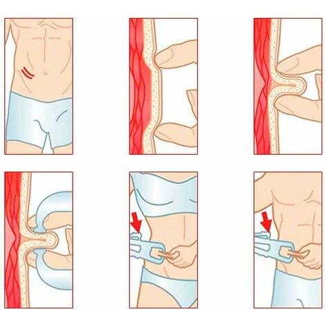 Pince Mesure De Graisse Corporelle Noir Mesure Du Taux Appareil Calibre Épaisseur Adipomètre Jauge Pied à Coulisse(noir),KoleZy 7 Pince Mesure De Graisse Corporelle Noir Mesure Du Taux Appareil Calibre Épaisseur Adipomètre Jauge Pied à Coulisse(noir),KoleZy – Image 5